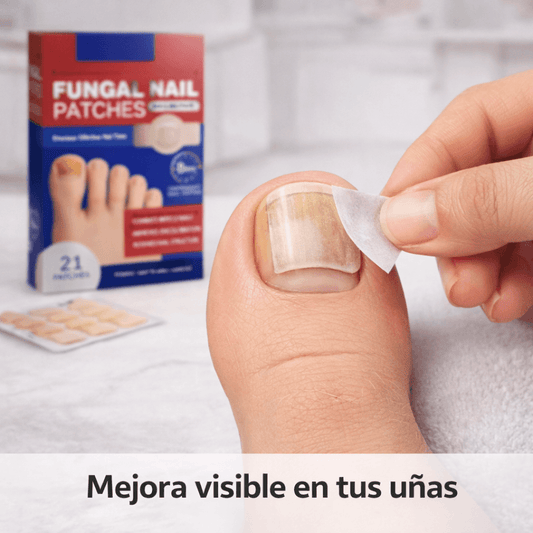 NailFix Pro - Mejora progresiva de tus uñas - Parches Anti Hongo para uñas