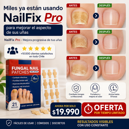 NailFix Pro - Mejora progresiva de tus uñas - Parches Anti Hongo para uñas
